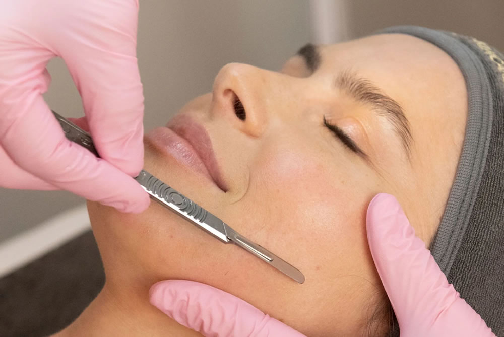 NEW DERMAPLANING FACIAL (1h15min)